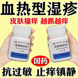 过敏湿疹止痒外用口服药顽固皮炎皮肤湿疹瘙痒红斑丘疹血痂脱屑S