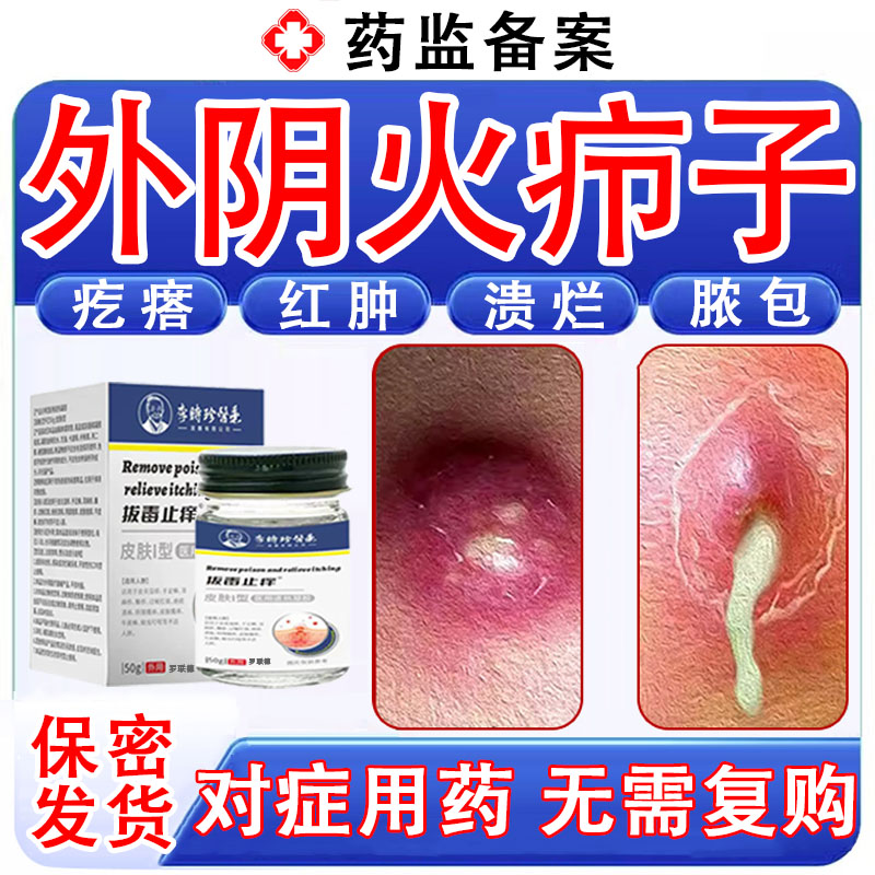 火疖子敷料贴皮脂腺囊肿