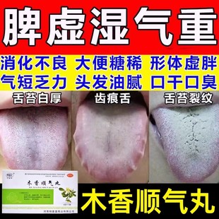 木香顺气丸官方旗舰店中成药健脾祛湿调理脾胃虚弱用化湿的功效