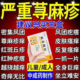 止痒颗粒正品官方旗舰店荆肤中成药成人治疗寻荨麻疹过敏专用特效