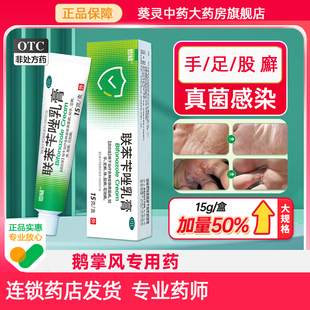 手足癣止痒水泡脱皮干裂真菌感染脚气手严重脱皮鹅掌风专用手癣膏