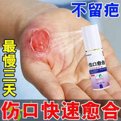 速发伤口癒合快速结痂不留疤促进长肉去腐生肌O外用喷剂手术伤口