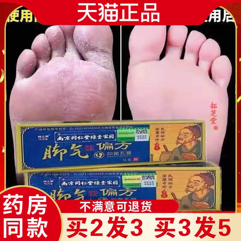 正朗快药南京同仁堂绿金家园脚气膏址痒偏方一抹灵乳膏8388