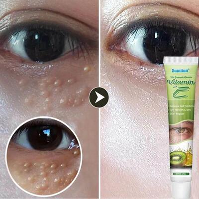 Fat Granules Remover Eye Cream Effective Remove Fat Granules