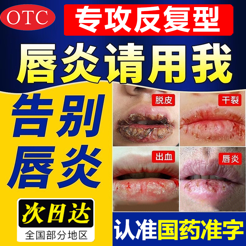 唇炎专用药膏嘴唇干裂脱皮儿童可搭医用唇膏湿疹药膏[药房直售]DD