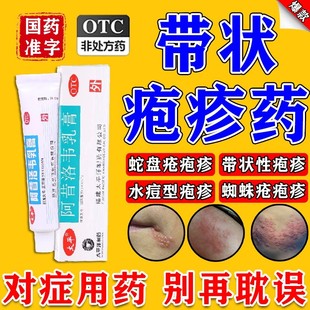阿昔洛韦软膏乳膏凝胶正品官方嘴唇角疱疹药带状泡生殖器疱疹梅毒
