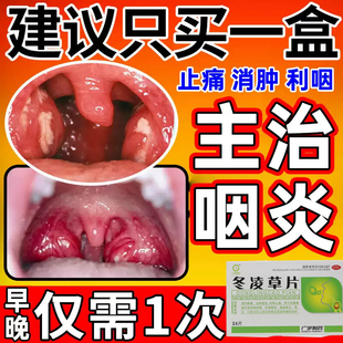 冬凌草片官方旗舰店咽喉肿痛喉咙发炎消炎特效i药喉咙干痒痛肿药