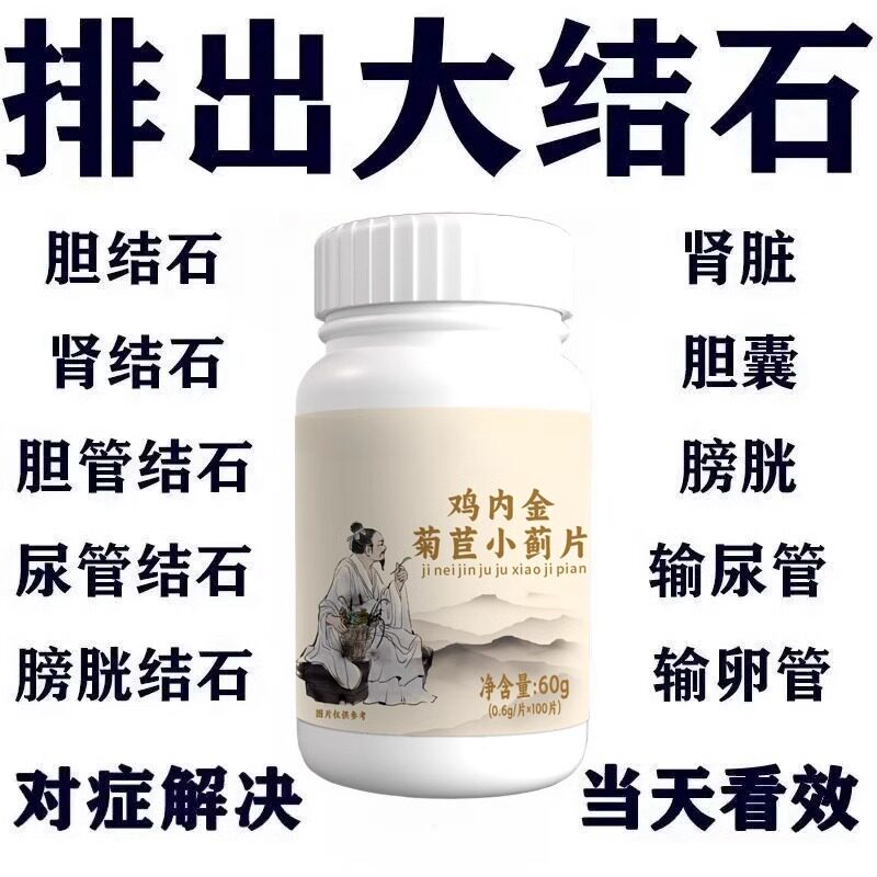 正品鸡内金菊苣小蓟片堵塞尿石胆石中药材提取碎石化石体内结石多