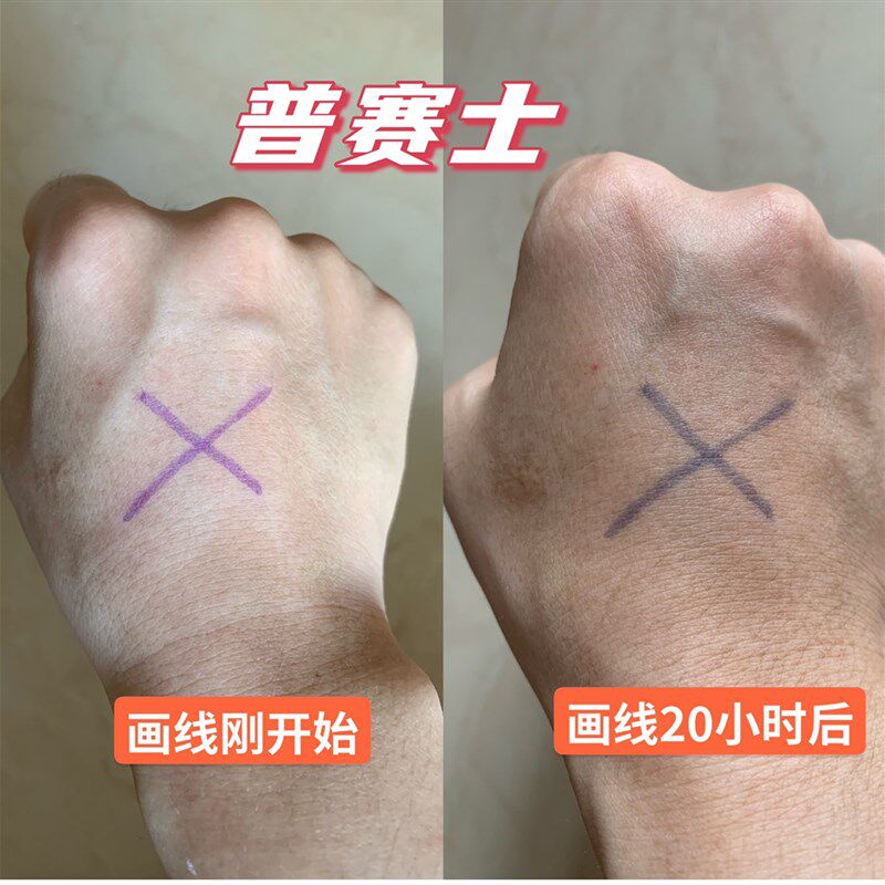 放疗定位记号笔皮肤划线标记着色长效持久防水不晕染可水洗普赛士