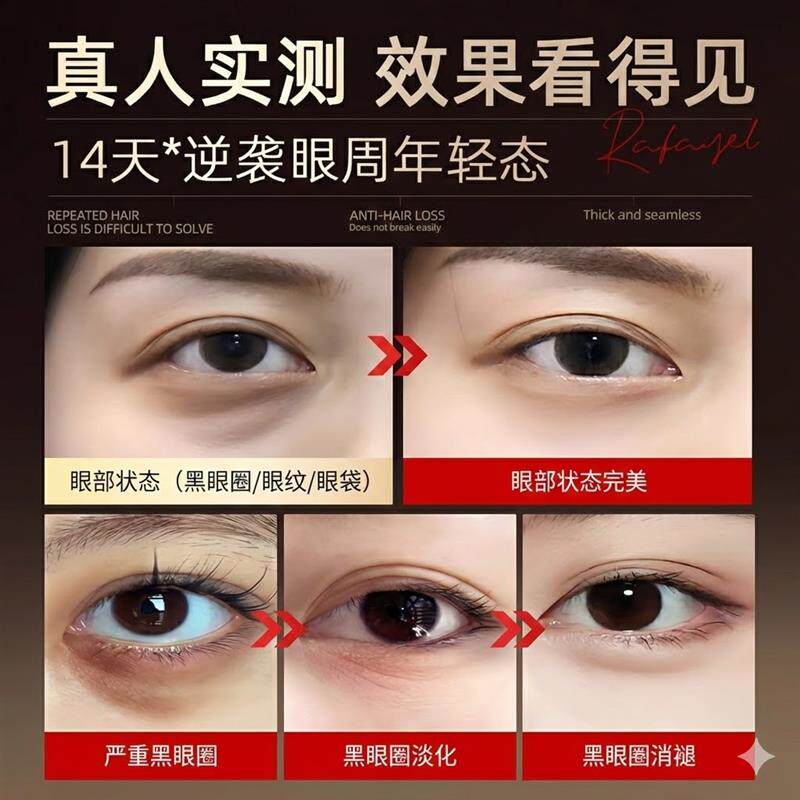 美眼仪眼部按摩器提拉紧致眼袋去除仪器消肿抗衰黑眼圈眼部美容仪