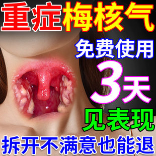 梅核气专用非药喉咙有异物感老有痰多吐不完嗓子咳嗽喷雾干痒肿痛