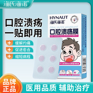 海氏海诺口腔溃疡膜灼痛嘴巴上火起泡口疮促进愈合口腔溃疡贴