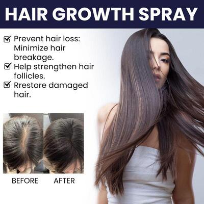 极速Hair Growth Spray Fsast Grow Anti Hair Loss Deep Conditi