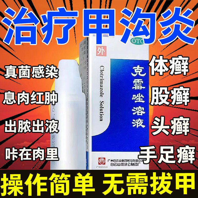 甲沟炎治疗专用药克霉唑喷雾溶液包邮非唯达宁达克宁治脚气的药
