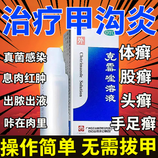 甲沟炎治疗专用药克霉唑喷雾溶液包邮非唯达宁达克宁治脚气的药