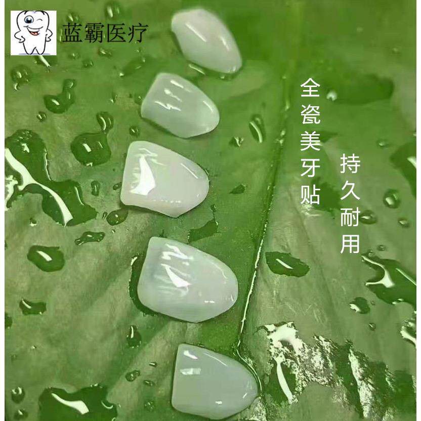 全瓷美牙贴面 牙齿贴片全瓷贴片私人美牙贴冰瓷蓝瓷琥珀瓷贴片