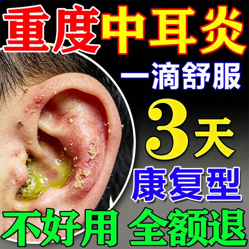 中耳炎专用效特药耳道发炎流脓除可根滴耳液油科耳聋耳鸣耳朵消炎