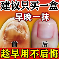 正品亮甲灰指甲专用药治疗脚趾甲变黄增厚脱甲软甲抗真菌感染药膏