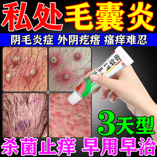 莫匹罗星软膏官方旗舰店外阴毛囊炎专用药膏私处瘙痒小疙瘩特药效