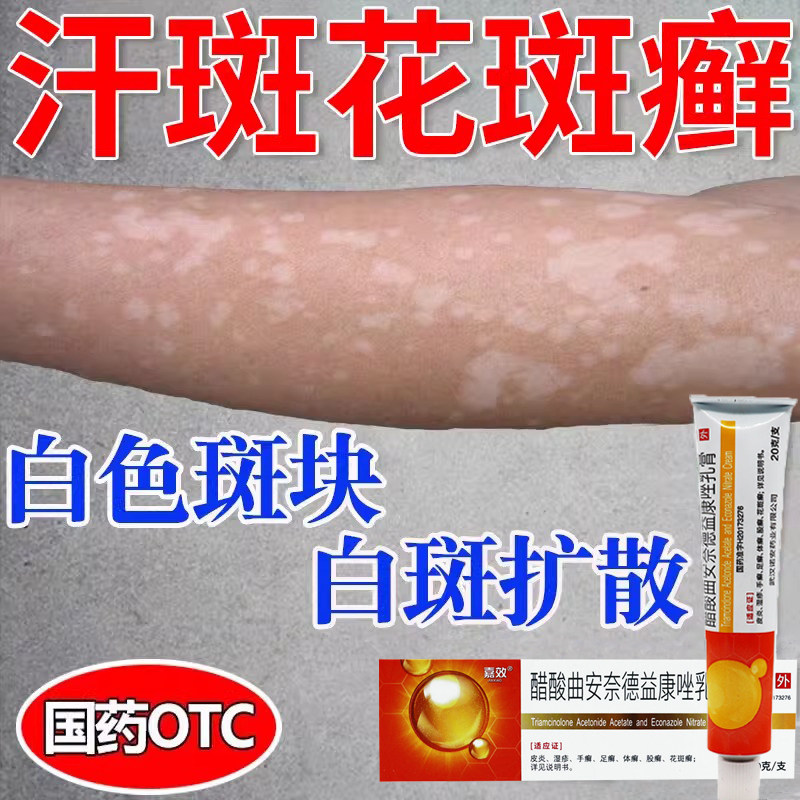 汗斑花斑癣专用药膏治疗体癣股癣头癣足癣皮肤真菌感染