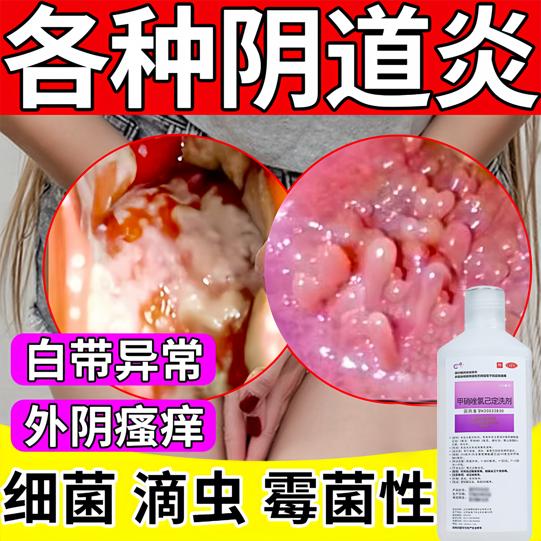 妇科洗液止痒消炎去异味治外阴瘙痒霉菌性阴道炎私处异味阴道腥臭