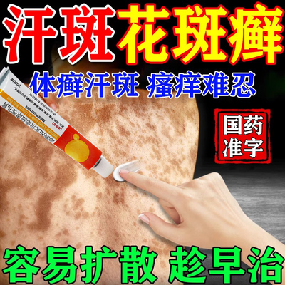 【嘉效】醋酸曲安奈德益康唑乳膏16.5mg150mg*20g*1支/盒