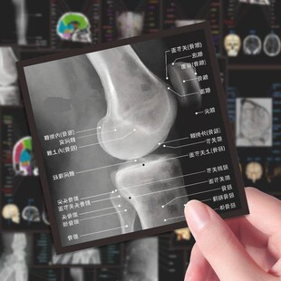 72张医学影像技术诊断学考研笔记高清大张规培生重点贴纸防水实用