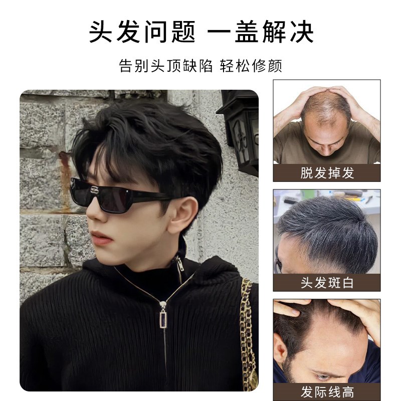 男士假发韩版帅气短卷发全真发头顶补发片蓬松卷发假发男生假发片