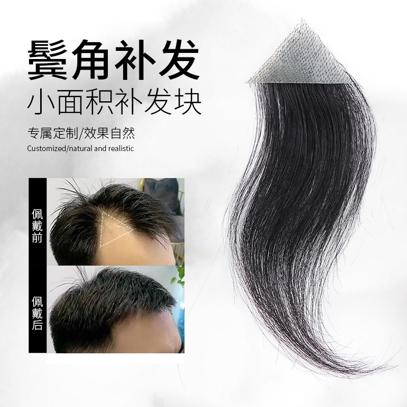 鬓角补发男女通用全真人发丝男士假浏海片前额头m型发际线假发贴