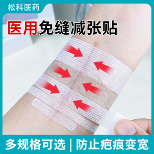 弘生医用减张贴皮肤伤口免缝胶带剖腹产甲状腺术后疤痕减张器透气