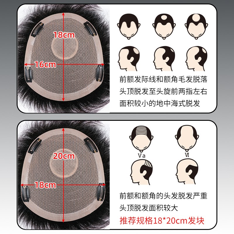 假发男短发全真发时尚摩根烫发款男士头顶补发自然逼真卷发假发片