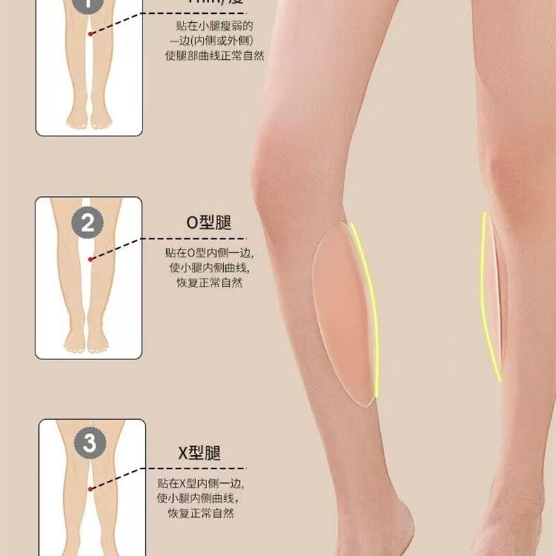 修饰腿型硅胶贴变直腿速矫正罗圈腿小腿外翻贴变直腿型弥补凹陷