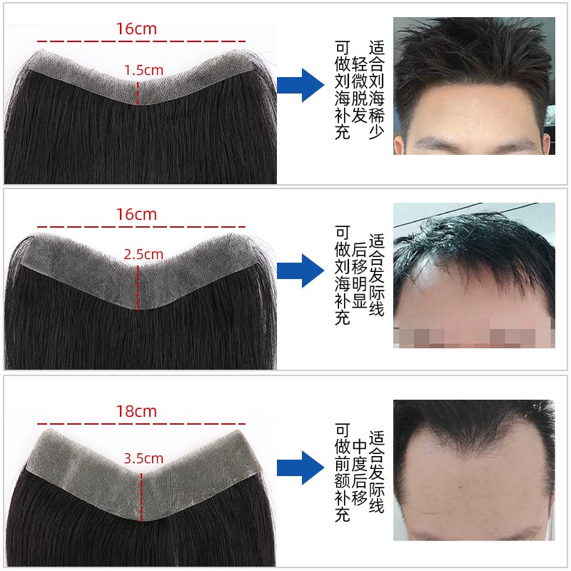 假发片男士隐形M型前额刘海片全真人发轻薄生物头皮发际线假发贴