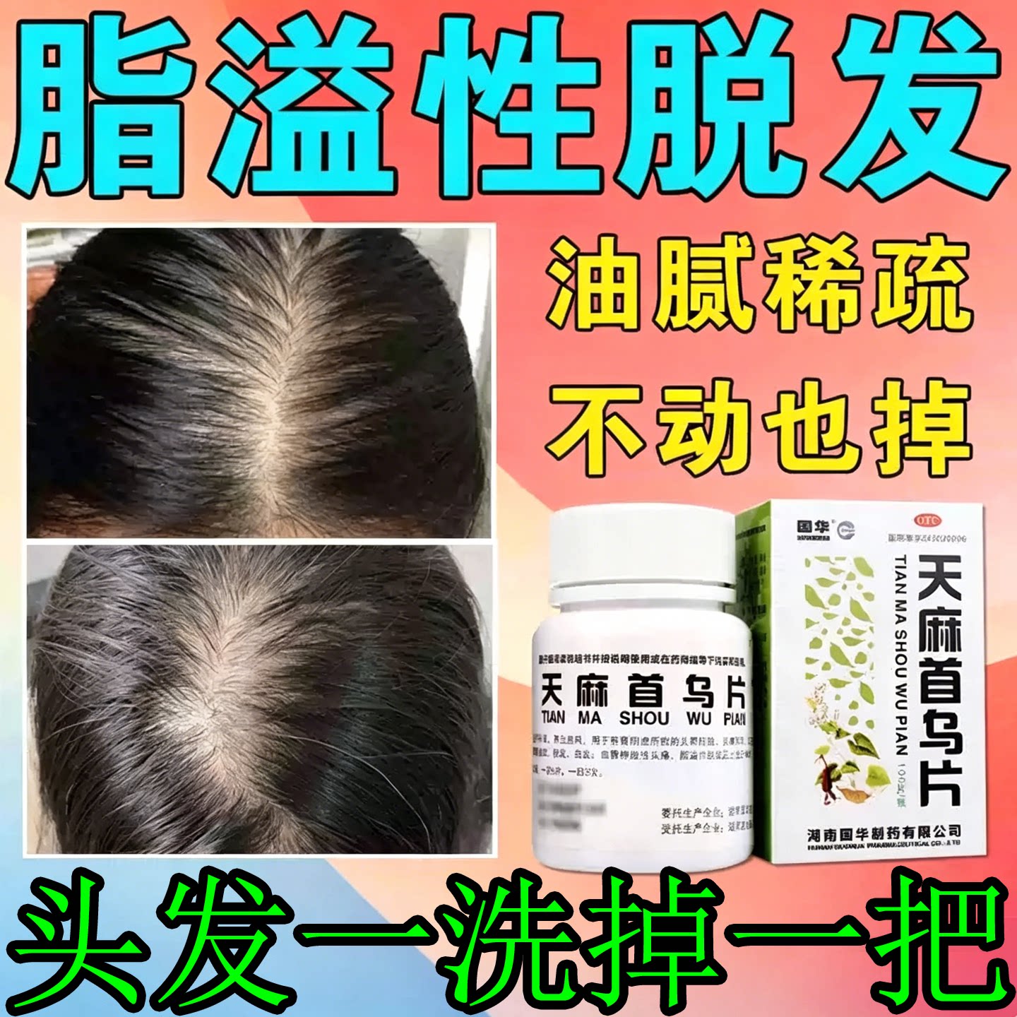 天麻首乌片脂溢性脱发白发脱发生白发脱发
