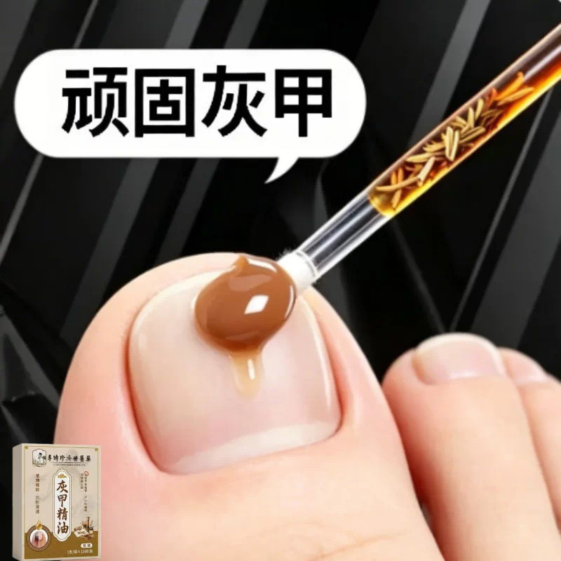 【官方正品】指甲精油正品专用灰趾贴植物萃取脚趾手指甲修护专用