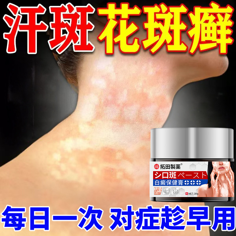 日本白斑净快速白斑专用黑色素生长补骨脂酊特效消白软膏