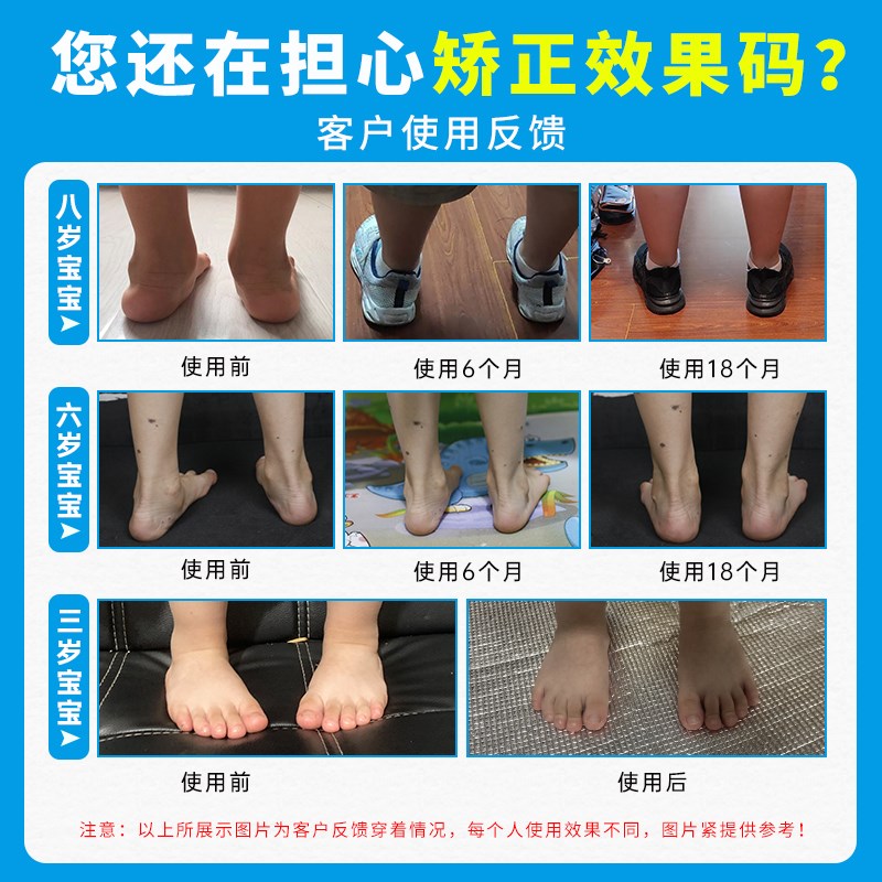 儿童内八字矫正鞋垫矫正器扁平足外翻矫正垫宝宝XO型腿足弓纠正鞋