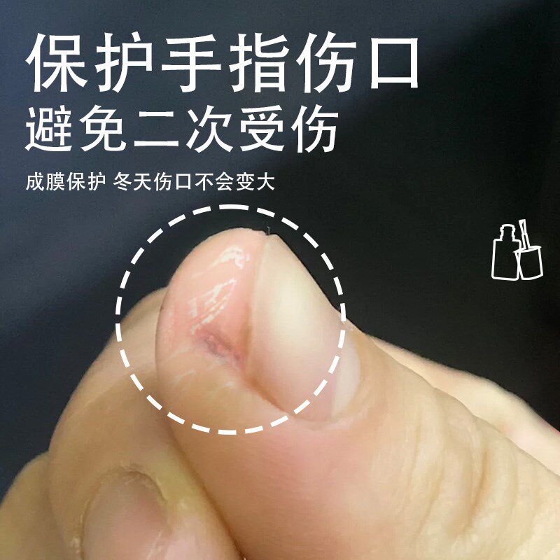手指头裂口保护套指甲缝手指头裂口子干裂开裂秋冬季手Y足裂开皲