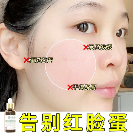 修复肌肤脸部乏红修护屏障受损精华红血丝过敏皮肤专用精油男女