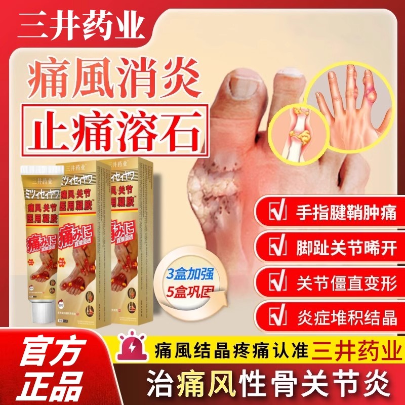 三井痛风凝胶止痛溶石去结晶
