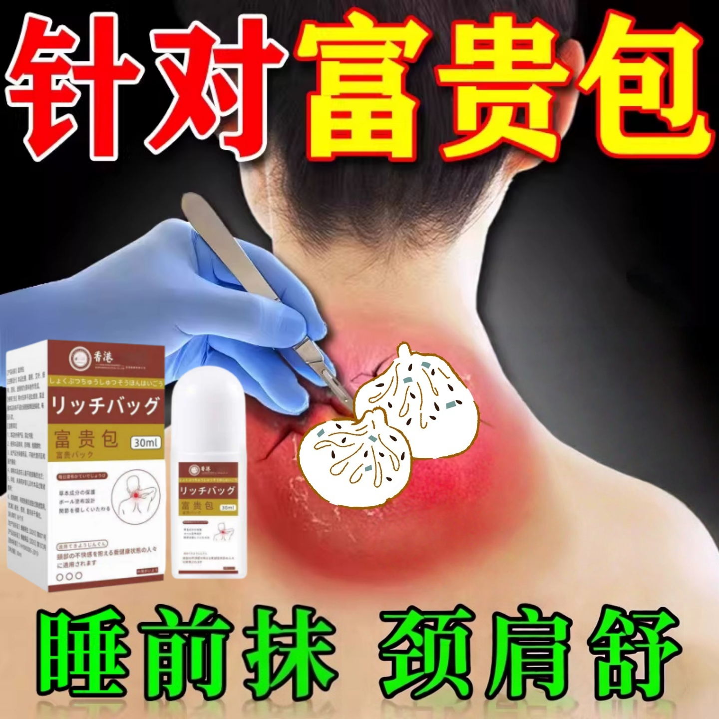 香港大药房科研富贵包膏官方旗舰店正品脖子前倾颈部鼓包疼痛