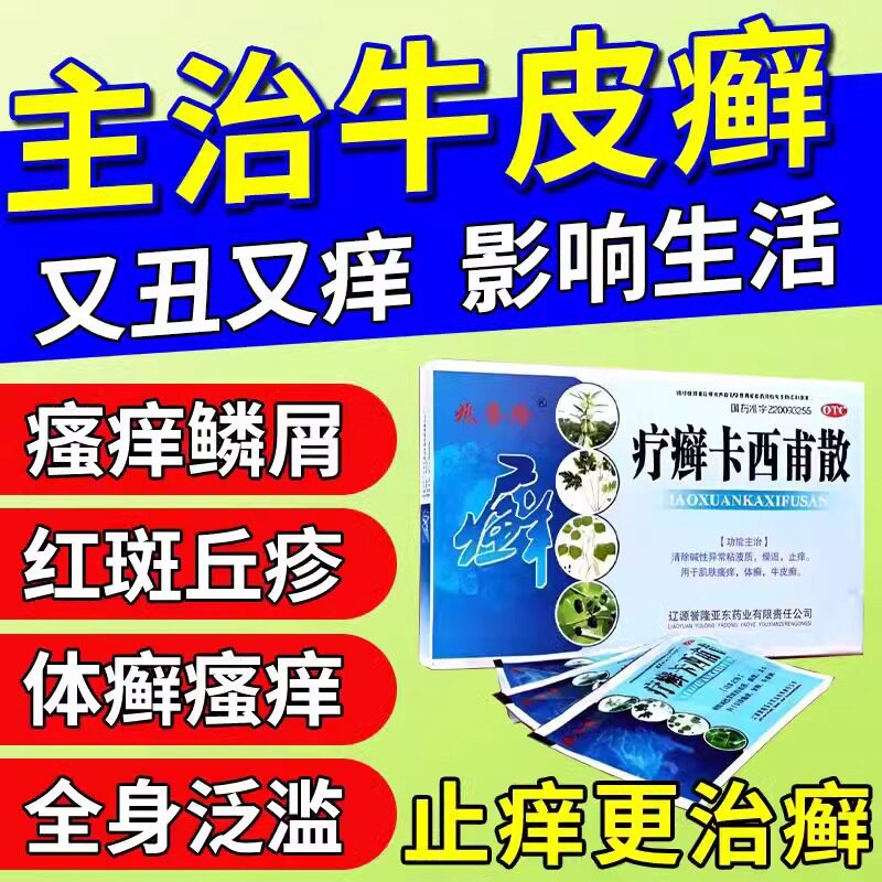 疗癣卡西甫散治疗牛皮癣的药牛皮藓银屑病专用药皮肤瘙痒口服中药