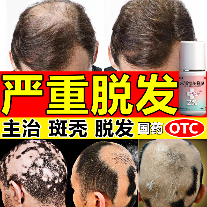 【斯必申】米诺地尔搽剂2%*30ml*1瓶/盒