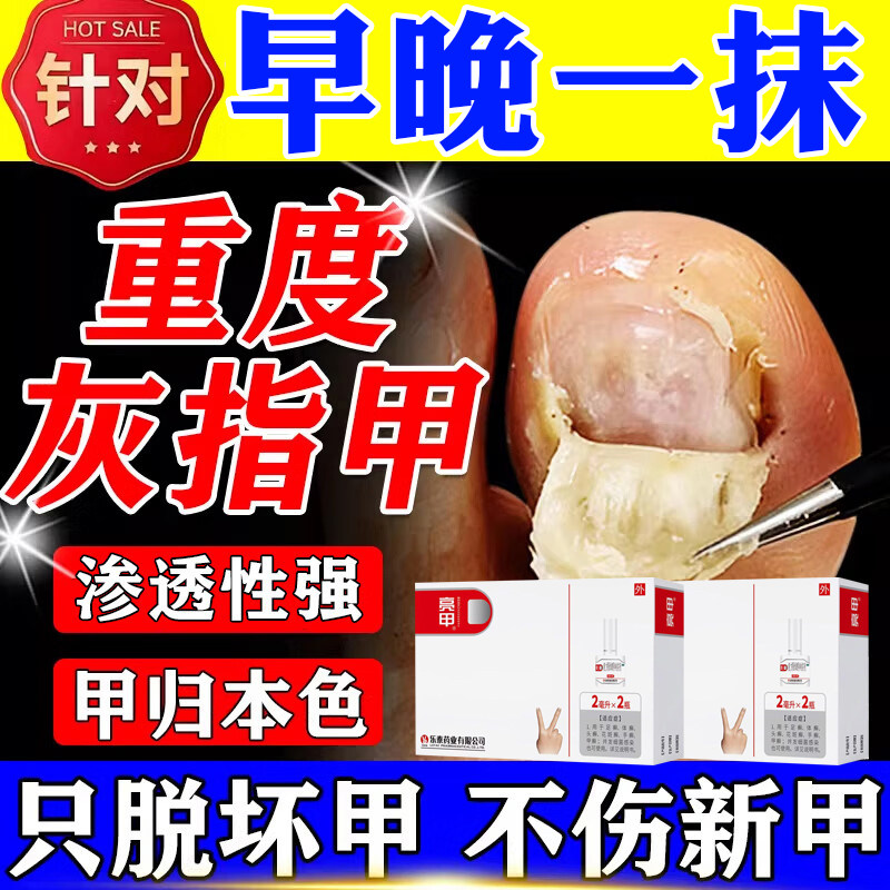治亮甲灰指甲专用药正品真菌感染特药效药正品官方旗舰店发黄增厚