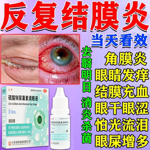 治疗结膜炎的眼药水过敏性结膜炎慢性结膜炎细菌性结膜炎专用滴液