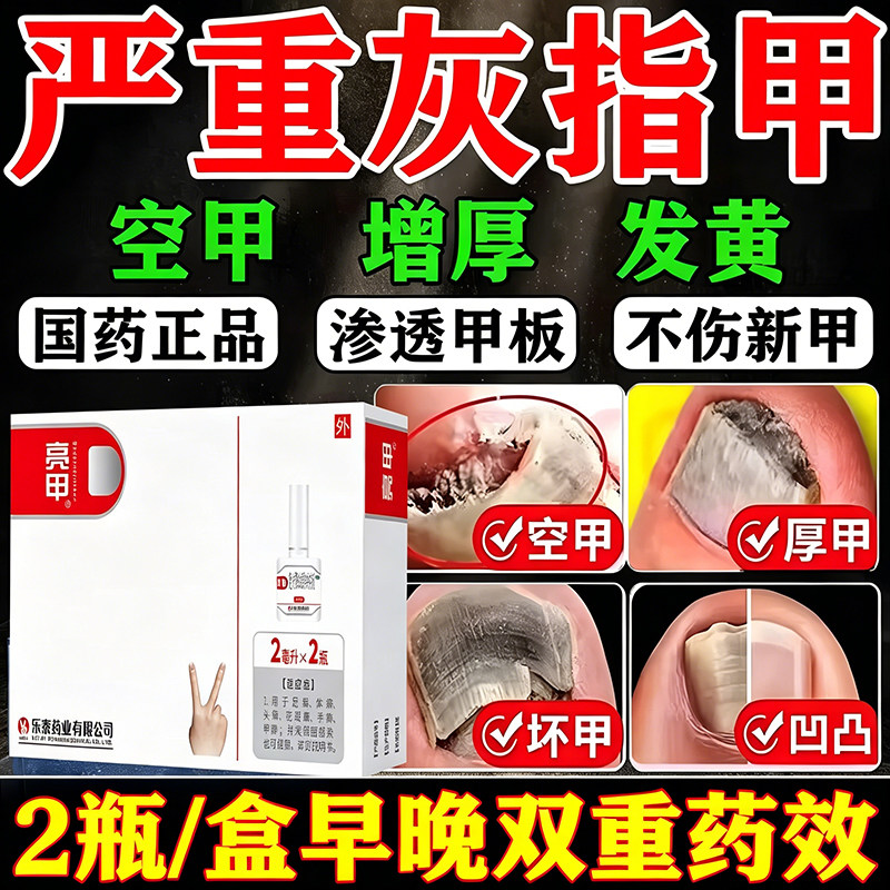 亮甲灰指甲专用药正品旗舰店特新效药根药治第药一名发黄增厚变色