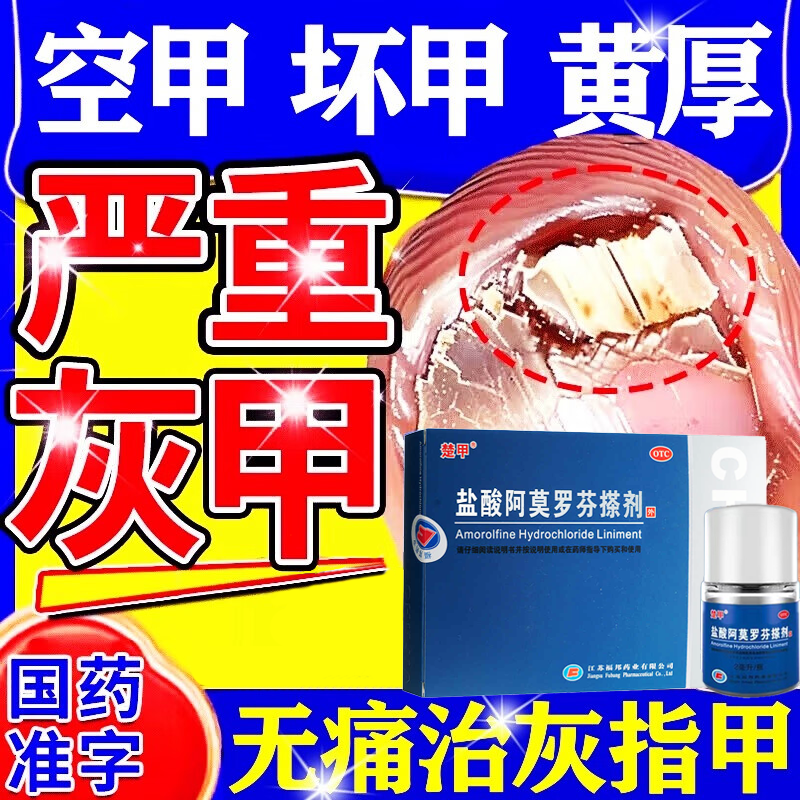 楚甲盐酸阿莫罗芬搽剂正品官方正品旗舰店灰指甲专用治疗真菌感染