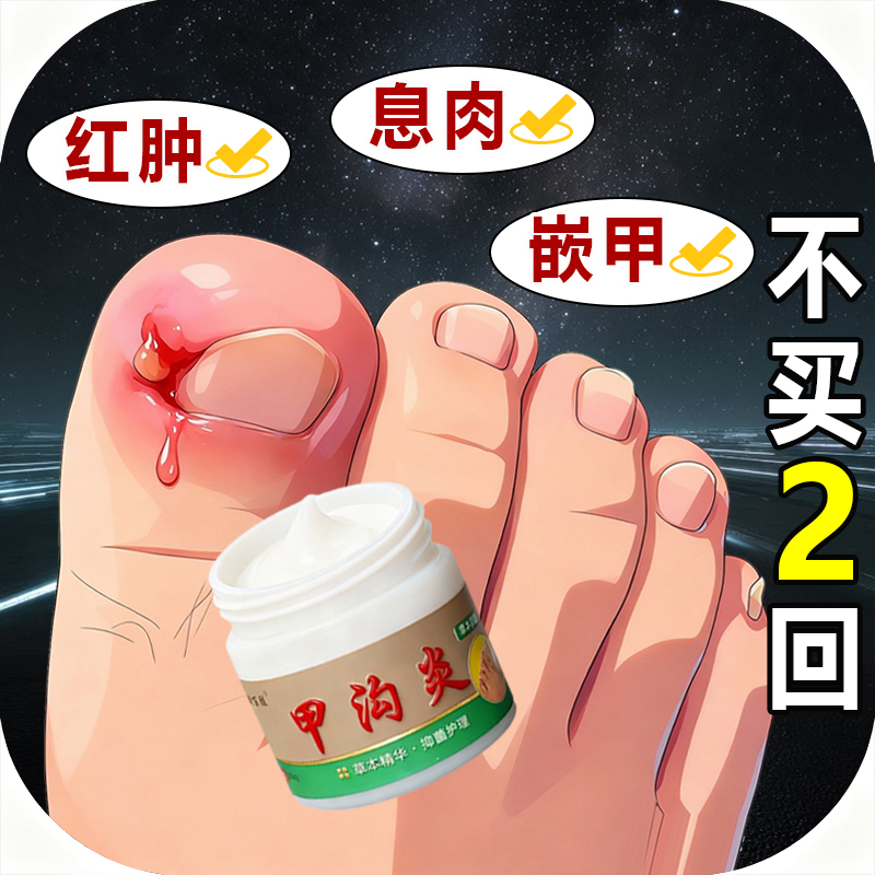【店铺热销】甲沟脚指甲疼大拇指往肉里长红肿化脓脚指甲止痛膏