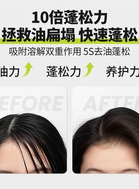 干发喷雾免洗去油蓬松清爽高颅顶神器头发控油神器UOIO
