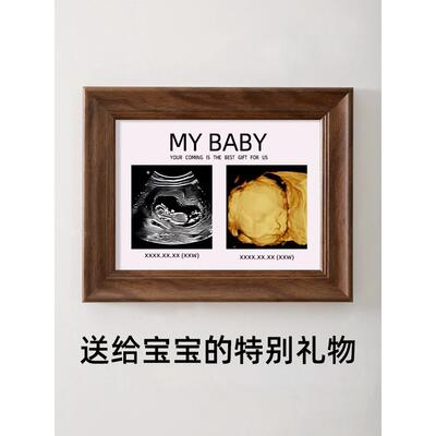 宝宝四维照片相框孕期产检彩超nt打印婴儿b超mybaby相册定制摆台